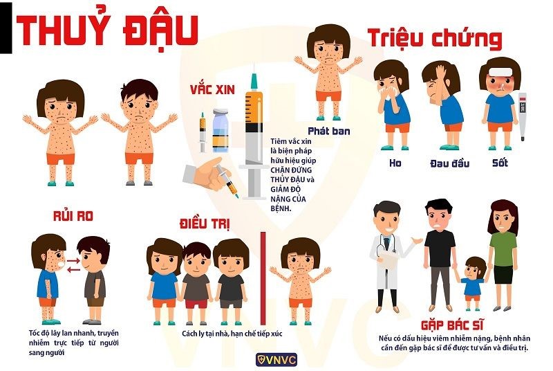 Cách nhận biết và cách phòng, chống bệnh Thủy đậu