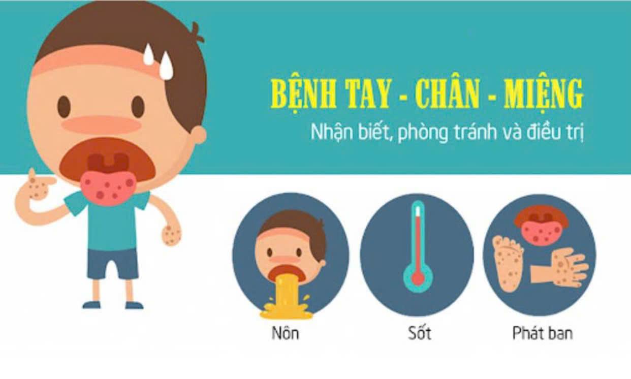 Những điều cần biết để phòng chống bệnh tay chân miệng ở trẻ nhỏ